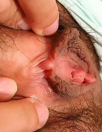 female hairy