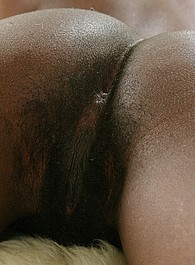 abnormal hairy girls