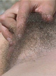 hairy arm