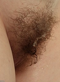 hairy fat