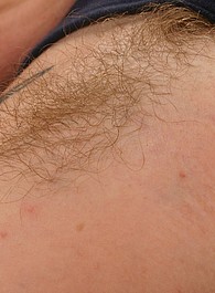 hairy girls ass