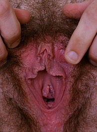 hairy timea atk