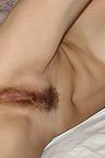 pussy hairy exposed