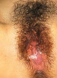 hairy girl toplist