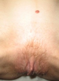 hairy white girls
