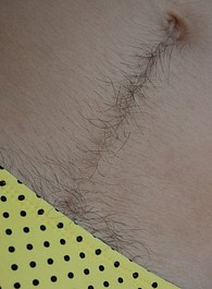hairy caribean girls